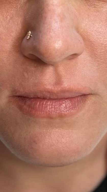 Lip Blushing Before & After Image