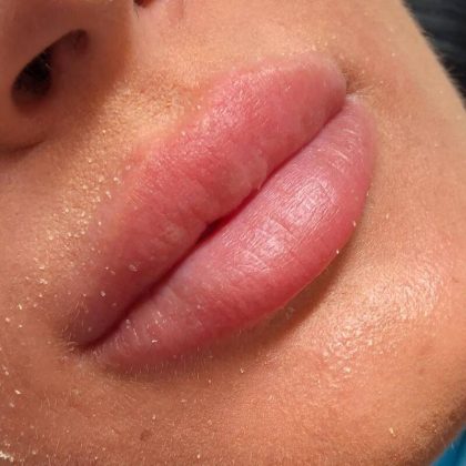 Lip Blushing Before & After Image