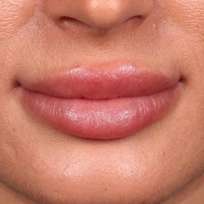 Lip Blushing Before & After Image