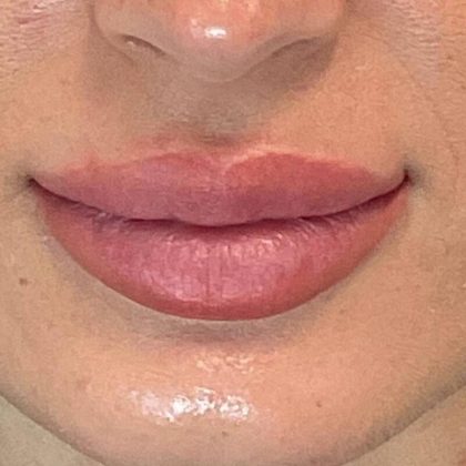 Lip Blushing Before & After Image