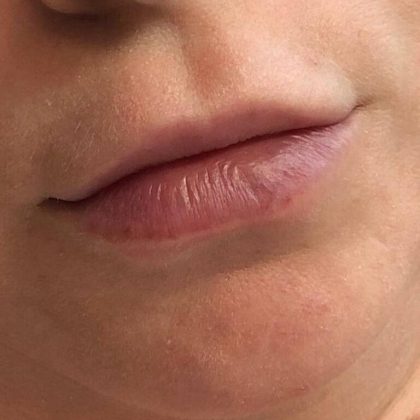 Lip Blushing Before & After Image