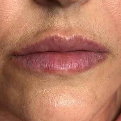 Lip Blushing Before & After Image