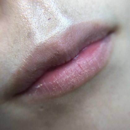 Lip Blushing Before & After Image