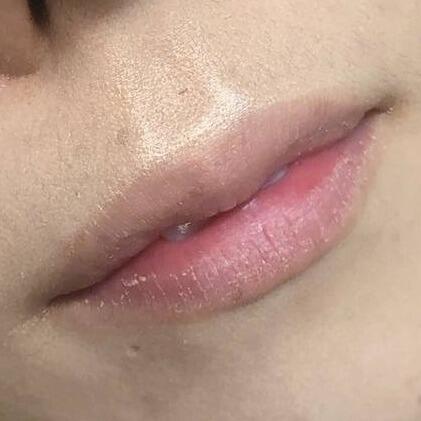 Lip Blushing Before & After Image