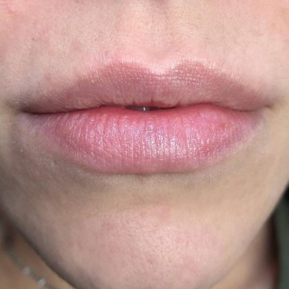 Lip Blushing Before & After Image