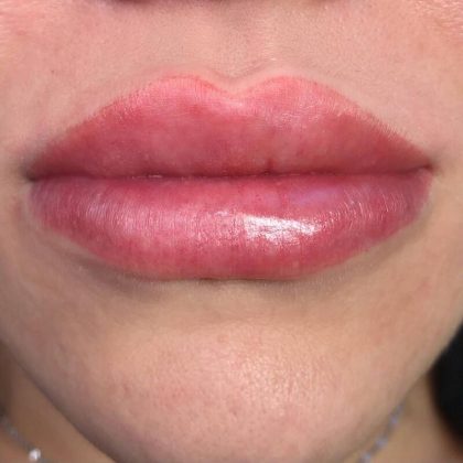 Lip Blushing Before & After Image