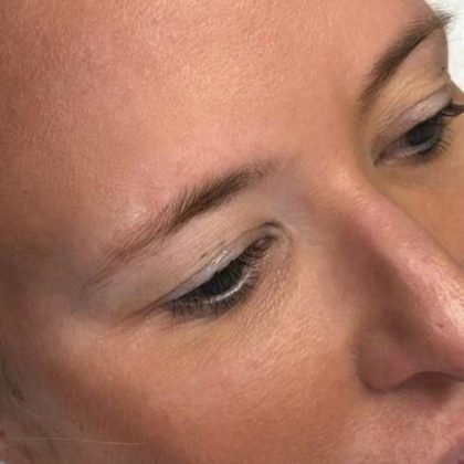 Microblading Before & After Image